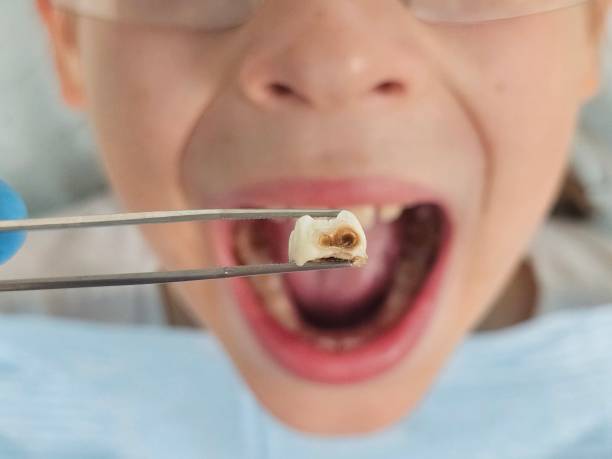 Best Cosmetic Emergency Dentistry in Chester Gap, VA