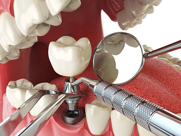 Best Cosmetic Emergency Dentistry in Chester Gap, VA
